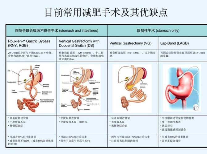 手術(shù)減肥方法,手術(shù)減肥方法有哪些