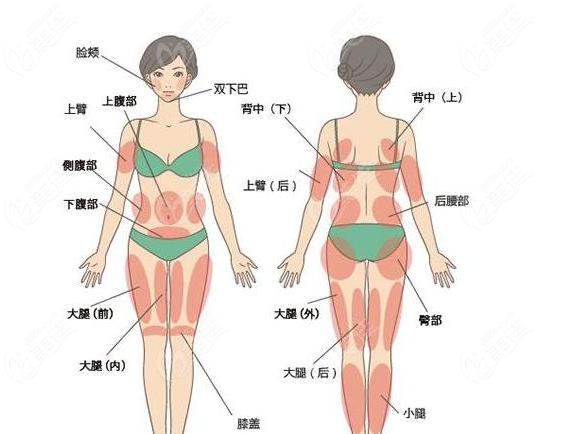 抽脂減肥方法,抽脂減肥方法有哪些