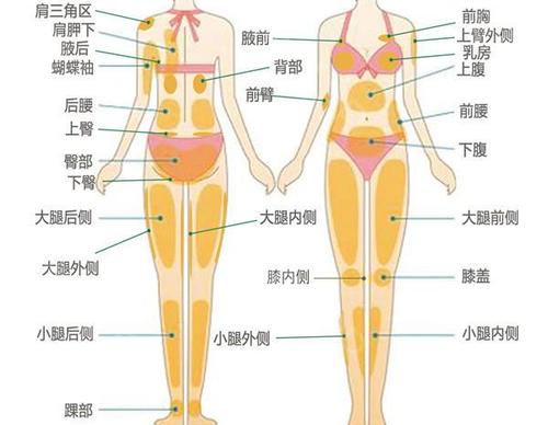 抽脂減肥方法,抽脂減肥方法有哪些